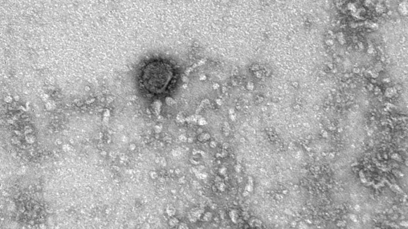 WHO claims risk of coronavirus infection even with antibodies