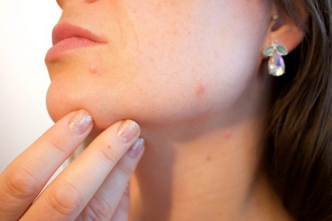 How do acne prolong life