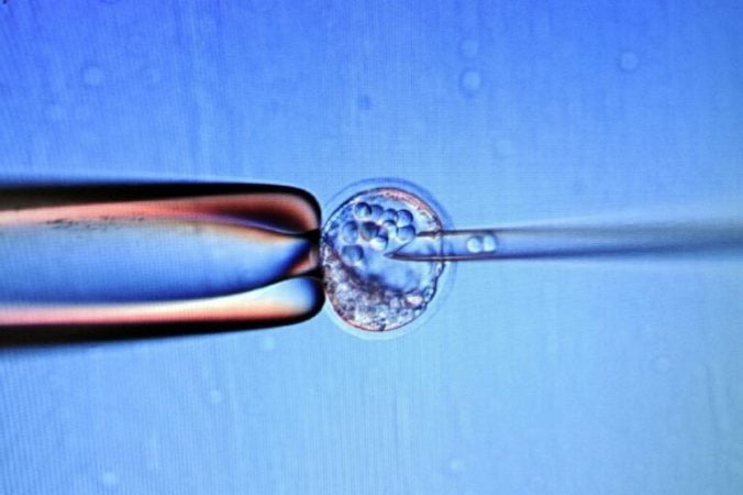 Scientists turned stem cells into liver cells and successfully transplanted them to their baby for the first time