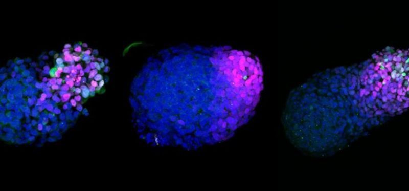 Stunning human stem cell embryo reveals unprecedented stages in our development