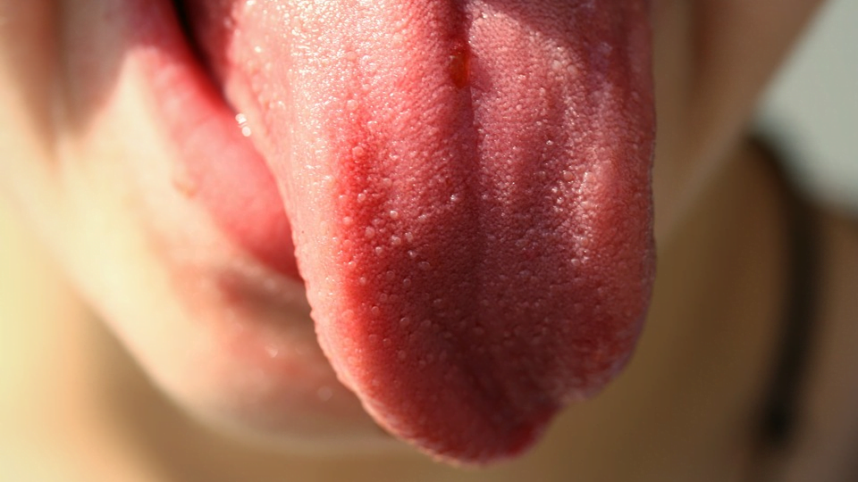 Tongue cancer doctors called symptoms that should not be ignored