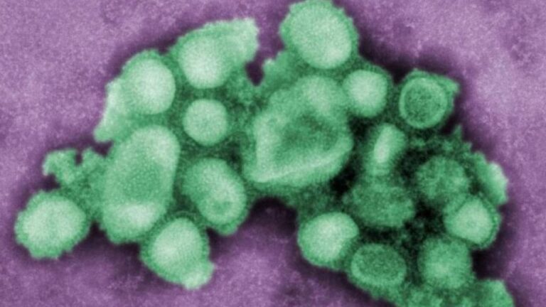 new strain of swine flu that could lead to a pandemic