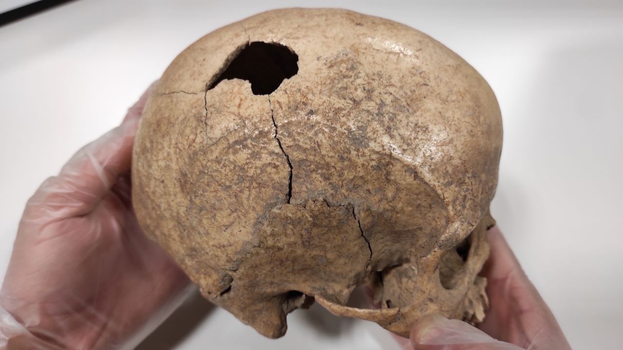 Archaeologists have discovered the skull of a man who lived five thousand years ago