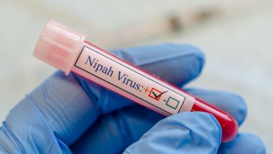 Experts warn pharmaceutical companies are not ready for the Nipah virus pandemic