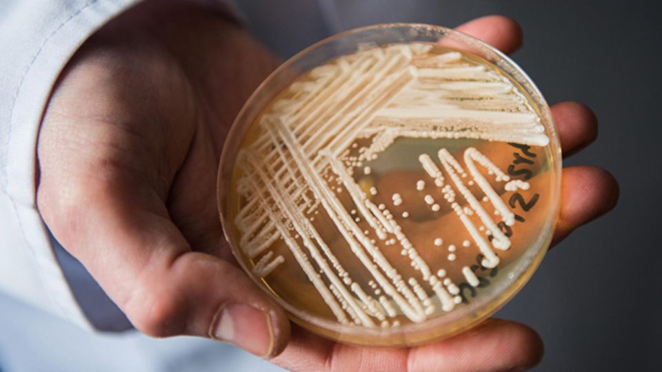 Doctors have named the symptoms of a fungal infection that does not respond to treatment