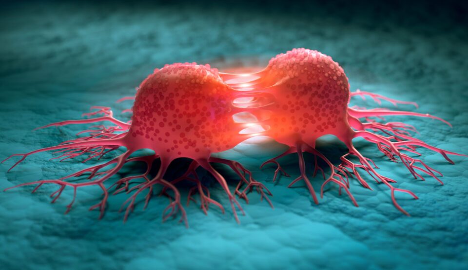 A new method for detecting cancer in the early stages has been developed