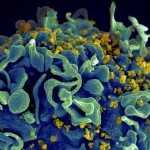 Cancer Drug Flushes Out Latent HIV Exciting New Study Finds