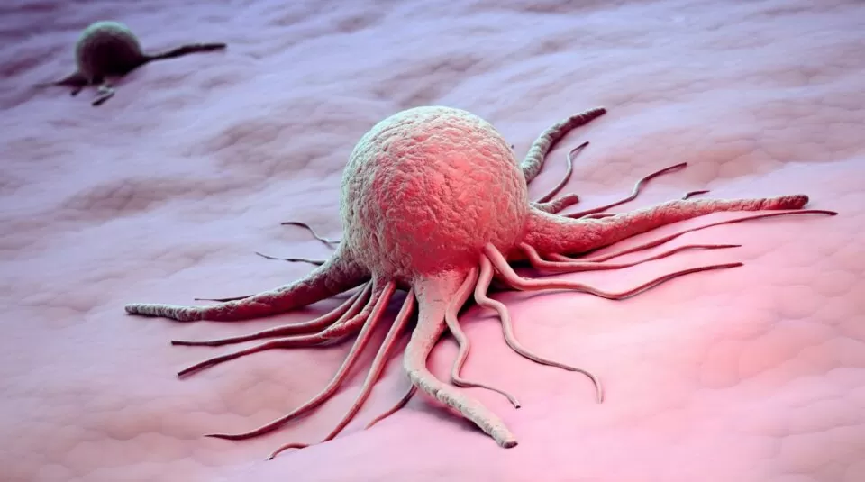 How to Reduce Cancer Risk by 70 Percent Scientists Says