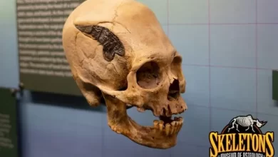 Ancient Peruvian skull with a metal implant