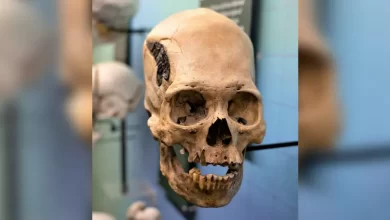 Ancient skull with metal implant found in Peru