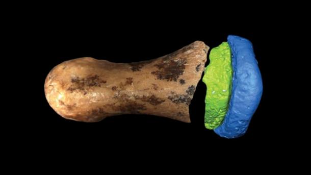 Did Autism Make the Denisovans Savants of the Prehistoric Age 2