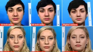 How selfies distort facial features a study