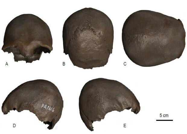 One of the oldest artificially deformed skulls found in China 1