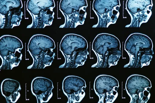 Scientists for the first time tracked how the human brain changes from birth to death