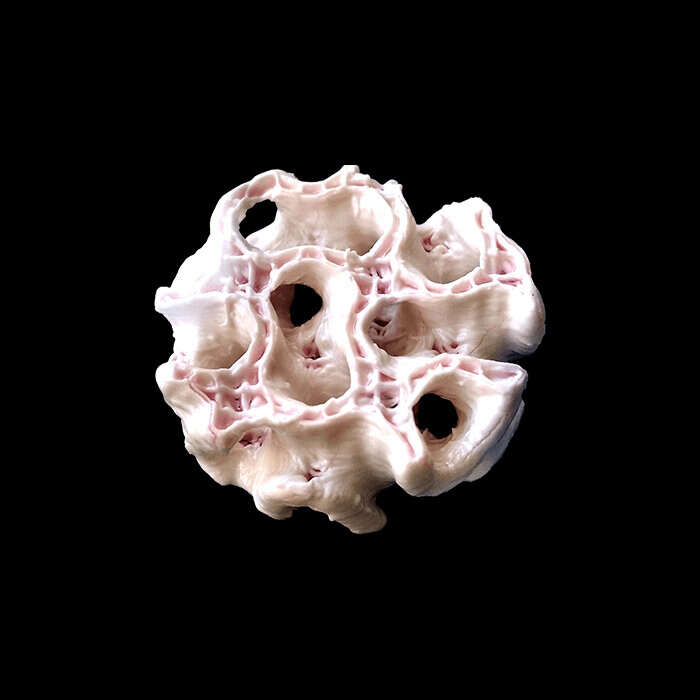 Space printed 3D bone for emergency medicine