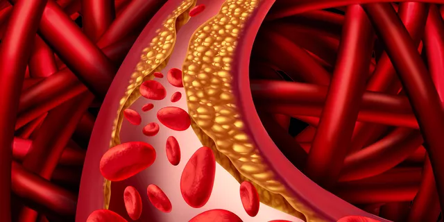 The truth about cholesterol
