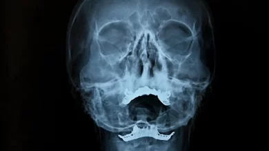 Tiny canals found inside the human skull could be vital to the brain 1