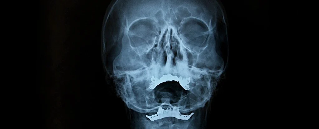 Tiny canals found inside the human skull could be vital to the brain 1