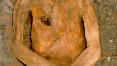 Biologists have analyzed gallstones from the mummy of a 16th century Italian nobleman