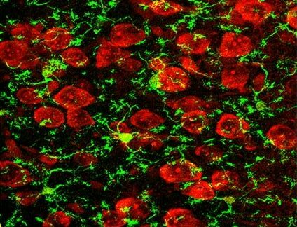 Intestinal bacteria responsible for brain cell death and cognitive decline with age found 1