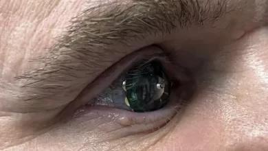 Augmented reality contact lenses and crime predicting AI
