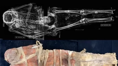 In Egypt found the mummy of a paralyzed woman after a stroke