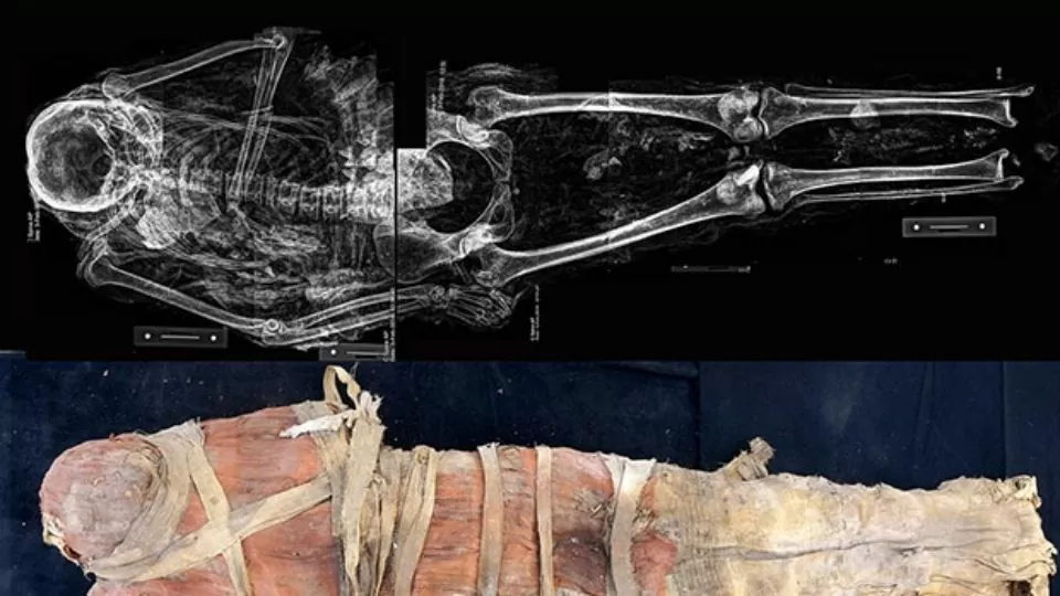 In Egypt found the mummy of a paralyzed woman after a stroke