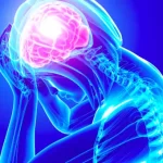 Migraine drug reduced weight in obese mice