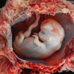 Scientists have solved the mystery of the evolution of the placenta