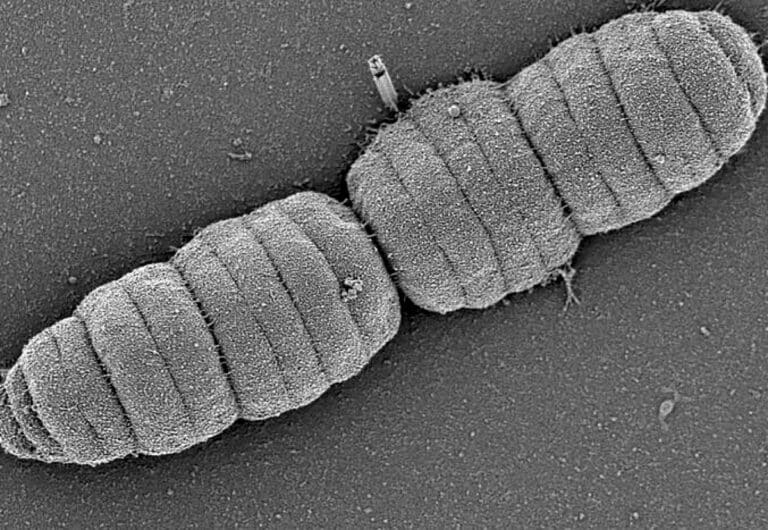 Biologists have found a caterpillar bacterium that lives in the oral cavity 2