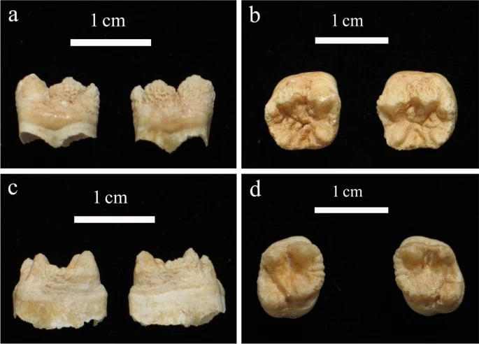 Child treated for syphilis found in plague grave in Sardinia 3 Child treated for syphilis found in plague grave in Sardinia 3