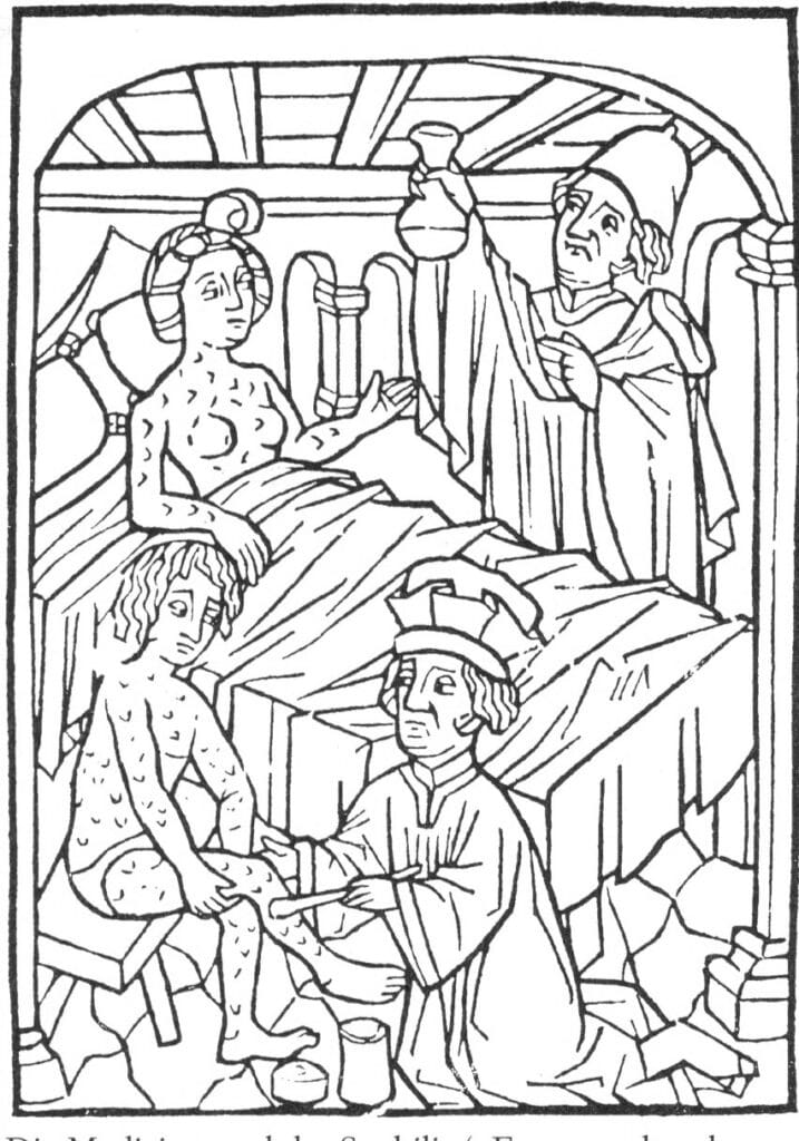Child treated for syphilis found in plague grave in Sardinia 4 Child treated for syphilis found in plague grave in Sardinia 4
