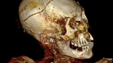 South American mummies were brutally murdered computed tomography showed