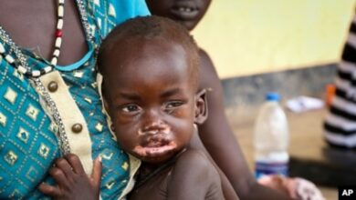 Zimbabwe measles outbreak kills 700 children despite vaccine available