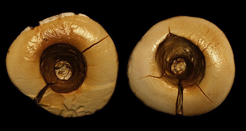 Dentistry in prehistoric times