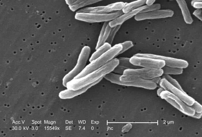 Scientists have found the protein reason for the success of the causative agent of tuberculosis 2