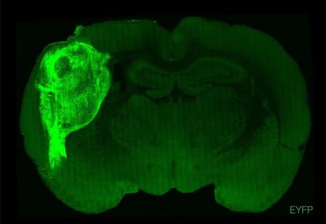 Scientists have fused human brain tissue with the brain of a rat 2