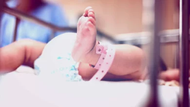 A girl with a very rare pathology was born in India