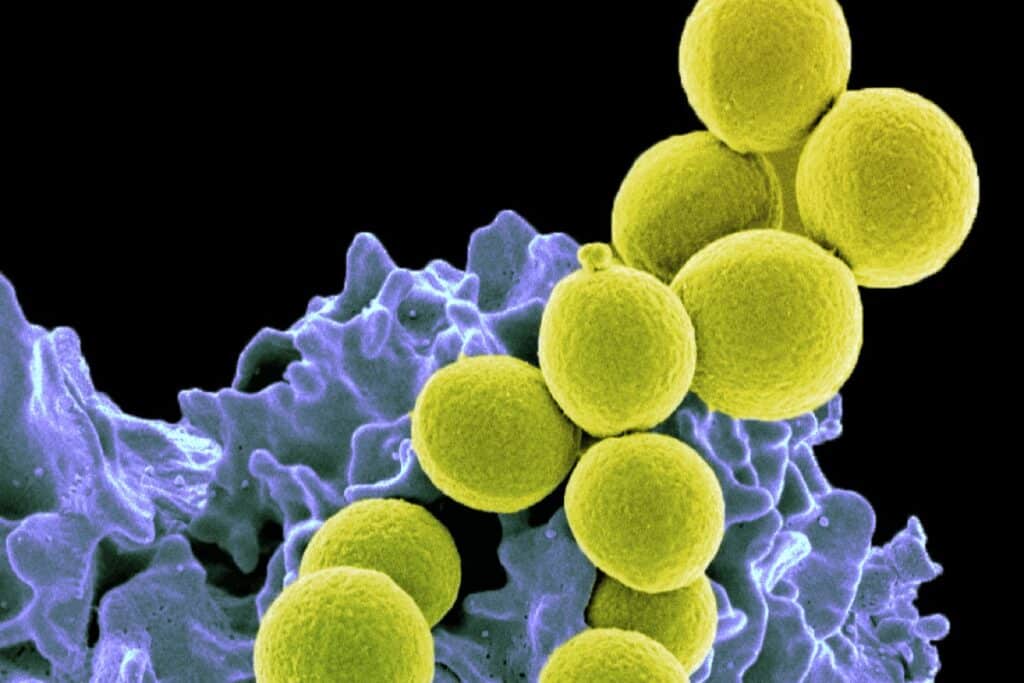 Antibiotics of the last reserve make bacteria harden 1