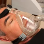 Sleep apnea is one of the main causes of Alzheimers