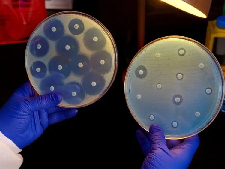 Antibiotic resistant bacteria can migrate through the body 6