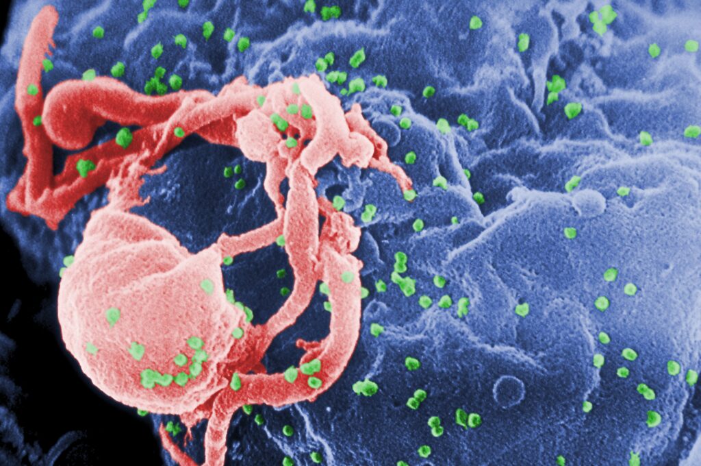 HIV infection affected the bodys immunological memory even with antiretroviral therapy