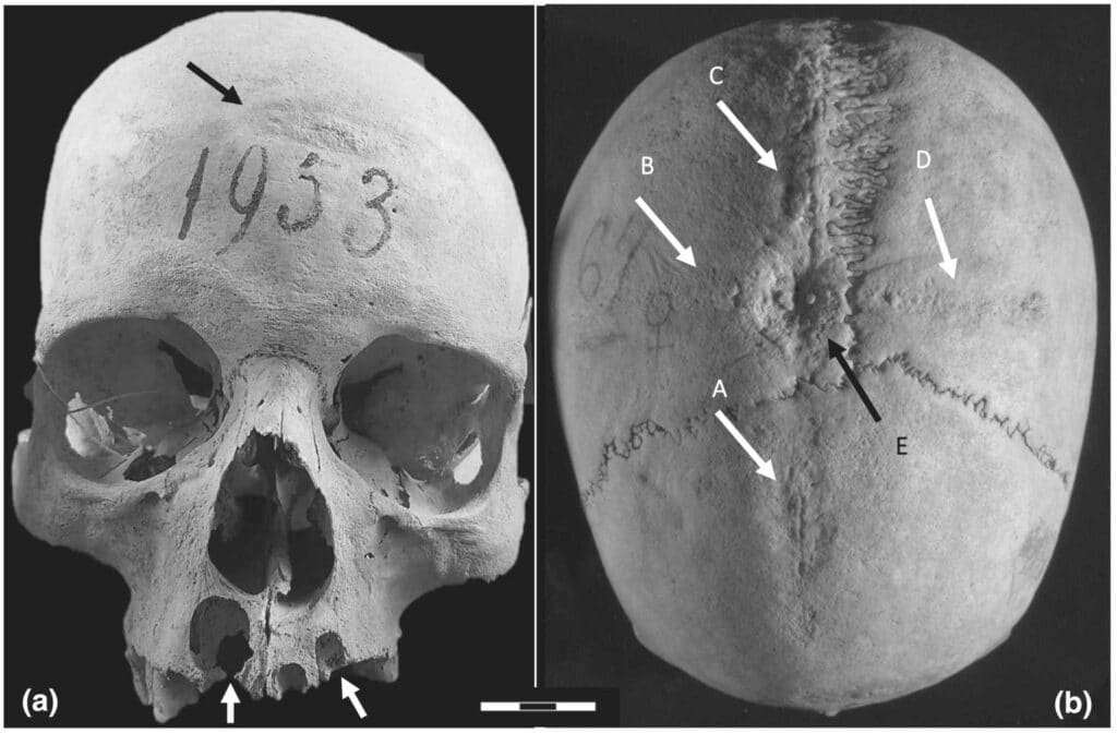 cross on the skull of a medieval woman caused controversy among scientists 1